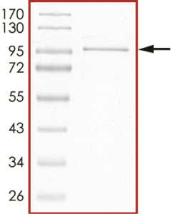 STAT5 Protein