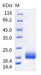 Recombinant Human TIGIT