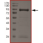 ZAP70 (Y319F), Active