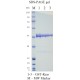 Kras(G12D), Gst-Tag