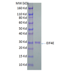 His-tagged Human Eukaryotic Translation Initiation Factor 4E