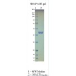 Human MALT1 (caspase-IG3)