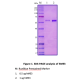 Recombinant Human Malic enzyme 3 (ME3) 