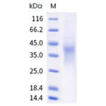 Human HVEM / TNFRSF14 Protein (His Tag)
