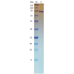 Recombinant SARS-CoV-2 Helicase (NSP13) 