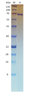 Recombinant SARS-CoV-2 Helicase (NSP13) 