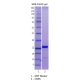 Recombinant SARS-CoV-2 NSP8 
