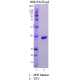 TEV Protease 