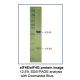 His-tagged Human Eukaryotic Translation Initiation Factor 4E Complexed With EIF4G