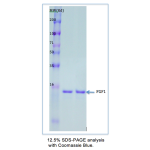 Recombinant Human FGF-Acidic: Carrier Free-Ready-To-Use
