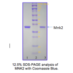 Recombinant Human MNK2 D228G